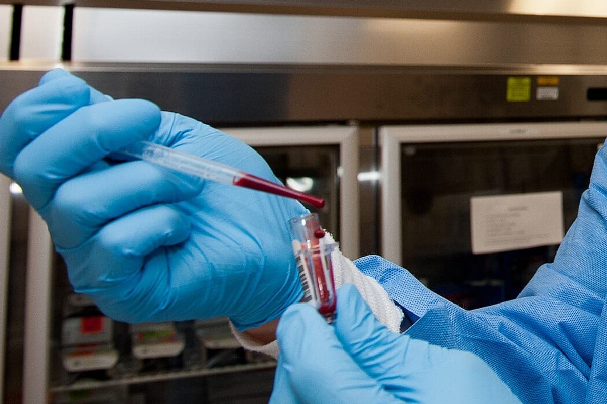 Colesterol LDL: Valores Ideais e a Meta Certa Para o Seu Risco