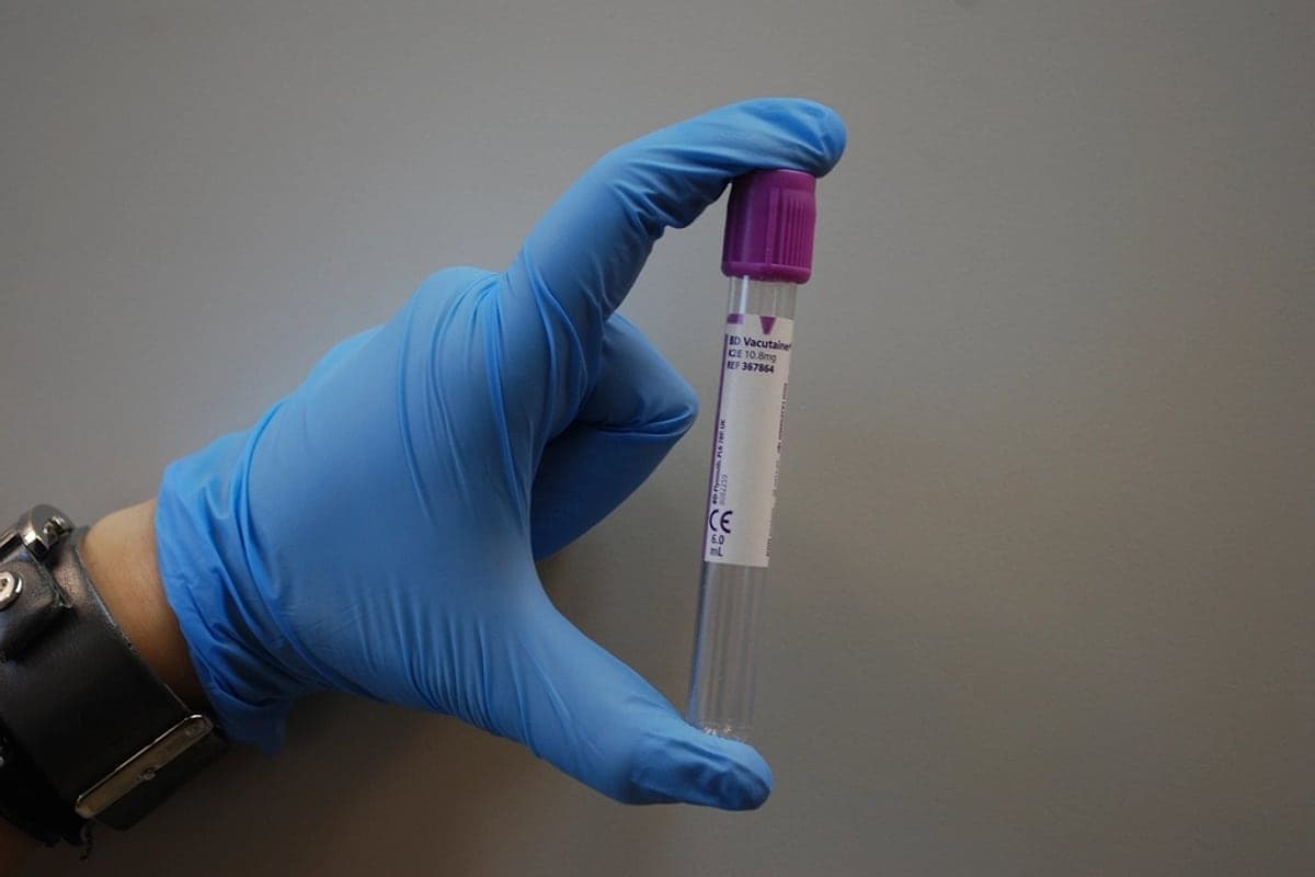 Colesterol: Mitos e Verdades Sobre o Vilão Mais Incompreendido da Nutrição
