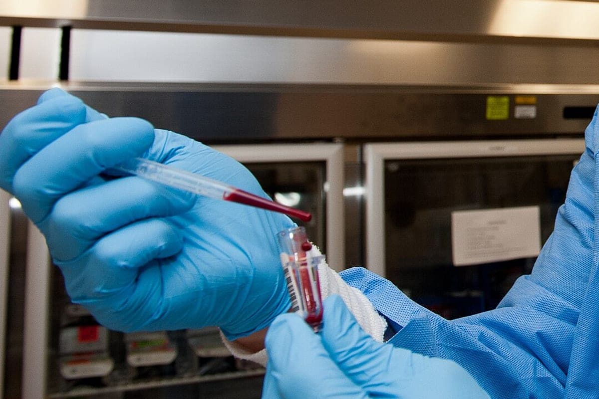 PCR Ultrassensível: O Que Significa o Resultado e Quando Pedir