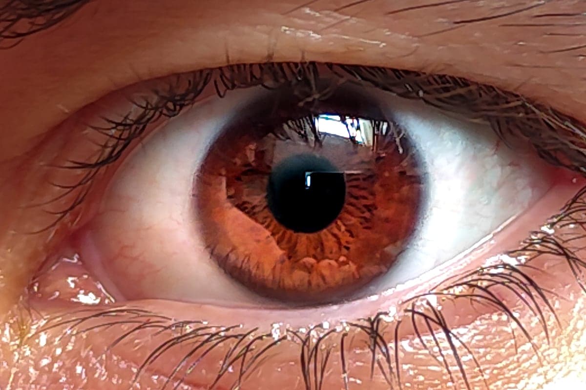 Saúde Ocular: os Nutrientes Que Realmente Protegem a Visão