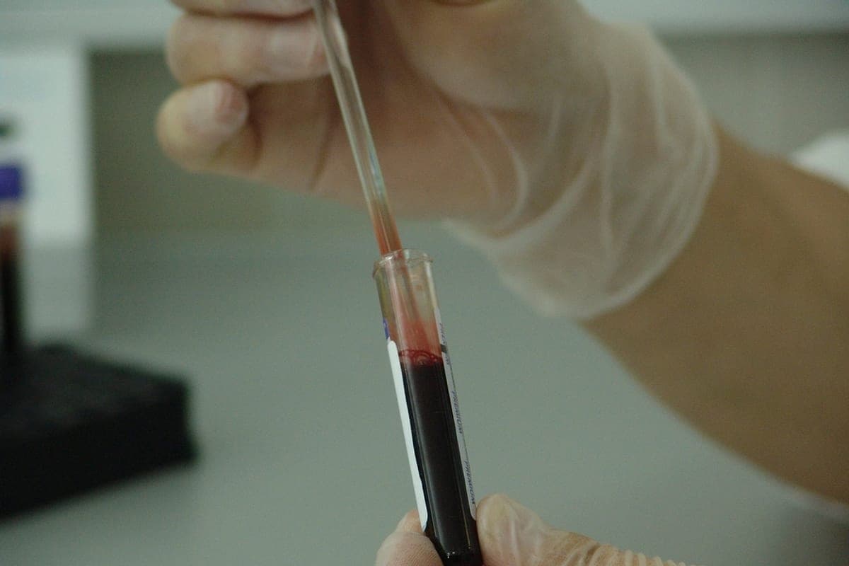 Sintomas de Diabetes: Os Sinais Que Aparecem Antes do Diagnóstico